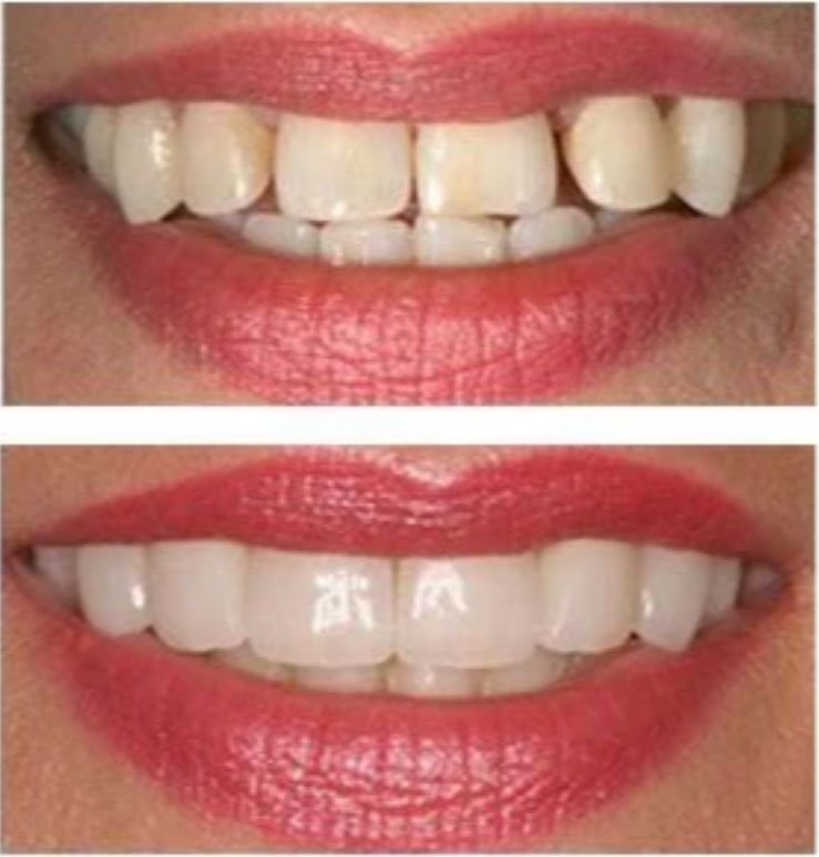 North Bend Dentist Office