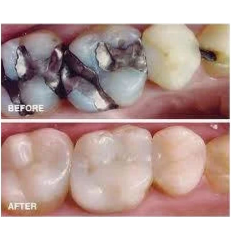 North Bend Dentist Office