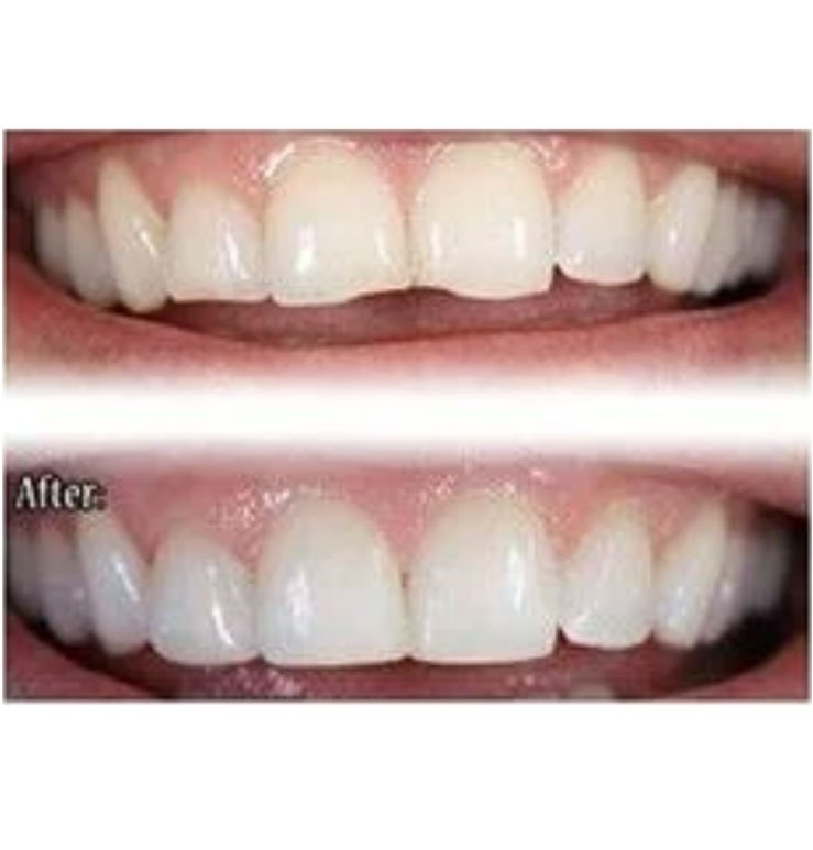 North Bend Dentist Office