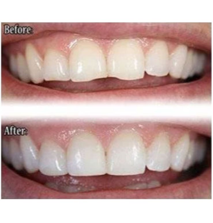 North Bend Dentist Office