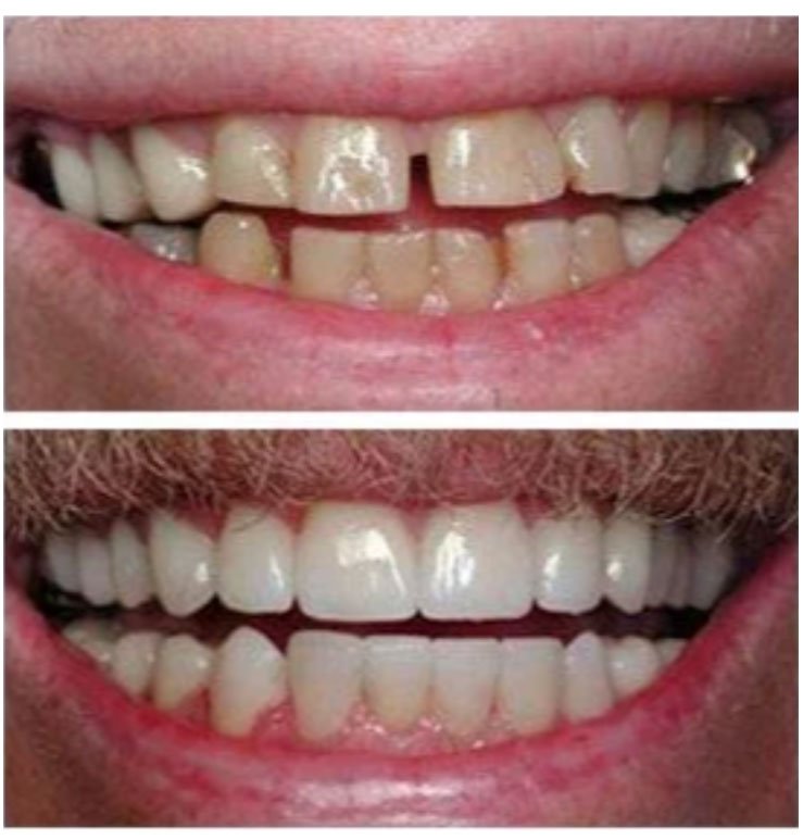 North Bend Dentist Office