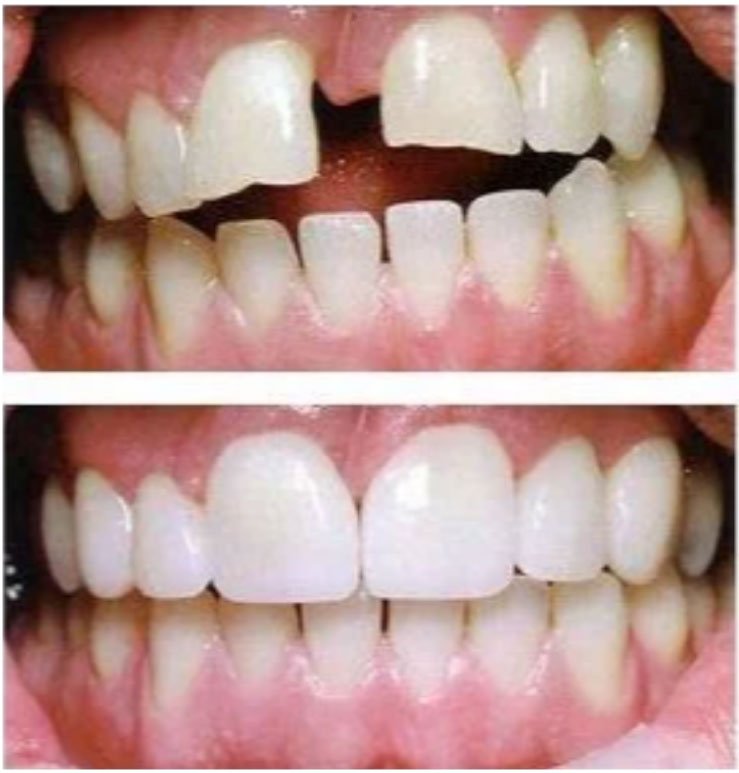 North Bend Dentist Office