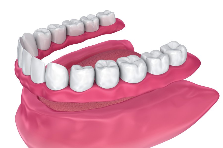 North Bend IMmediate Dentures