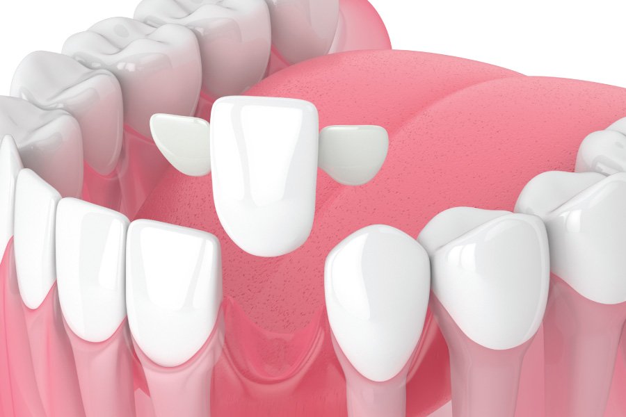 North Bend Maryland Bridges